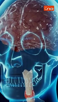 #EnRedUno | ¿Qué es el virus de Oropouche?. #RedUno #Notivision #Mundo #Virus #Oropouche