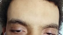 1000000244