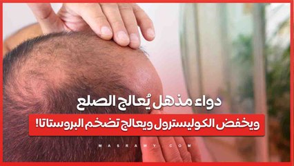 دواء مذهل يُعالج الصلع ويخفض الكوليسترول ويعالج تضخم البروستاتا!?