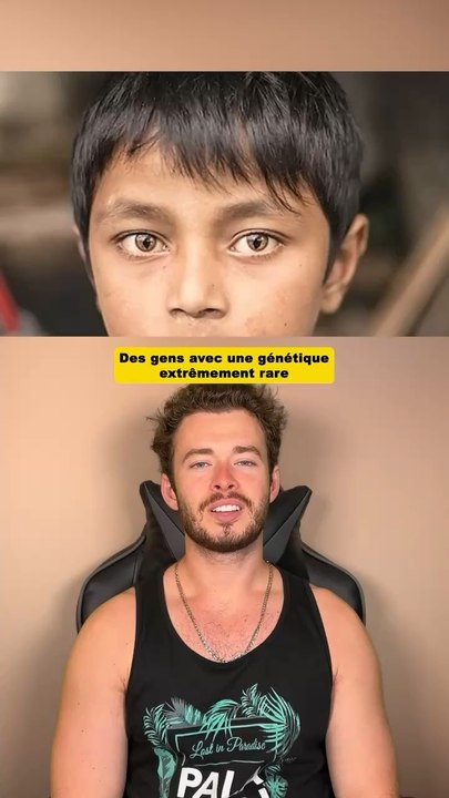 Des gens avec une génétique extrêmement rare