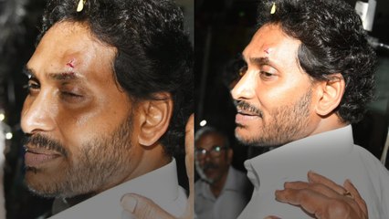 Ys Jagan పై దాడి Sympathy కోసం అంటూ TDP వ్యాఖ్యలు.. Oneindia Telugu