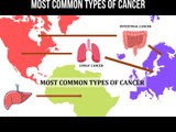 Most common types of cancer