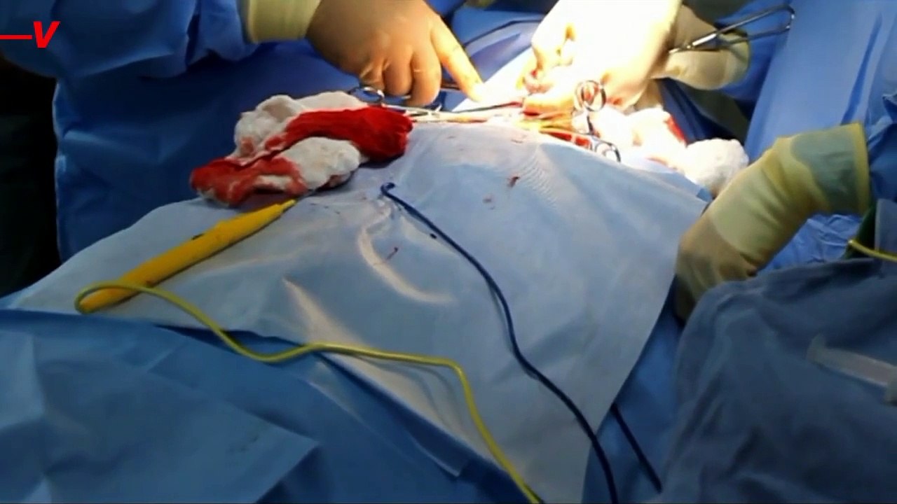 Patients With “Hospital-Acquired Infections” May Be Bringing Bacteria In With Them