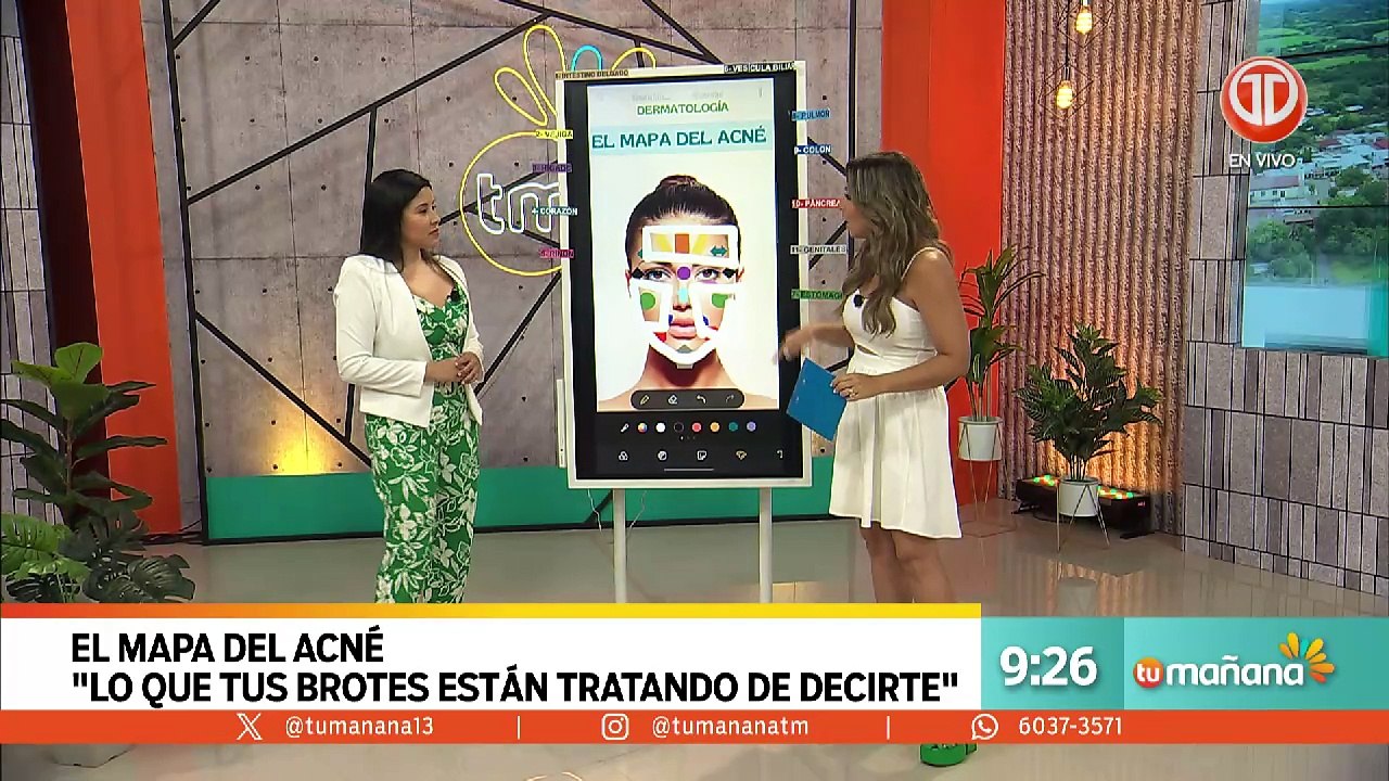 MAPA DEL ACNÉ.mp4