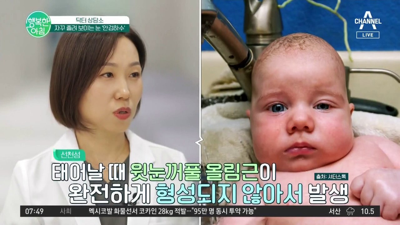 눈의 건강을 해치는 졸린 눈, 안검하수! 꼭 쌍커풀 수술을 해야 하나요? #안검하수