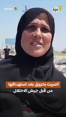 الفلسطينية ابتسام أصيبت بحروق بعد استهدافها من قبل جيش الاحتلال أثناء محاولتها العودة إلى غزة أمس