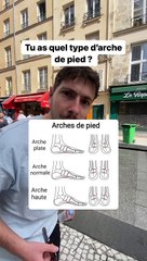 Découvre Quel est ton Type d'Arches de Pied ! (Exclusivité Dailymotion)