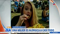 Mujer es alérgica a casi todo