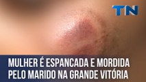 Mulher é espancada e mordida pelo marido na Grande Vitória