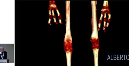 E.T grávida causa em conferência sobre múmias alienígenas no Peru