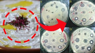 दही में कौन सा जीवाणु पाया जाता है | Dahi Me Konsa Bacteria Hota Hai | Boldsky