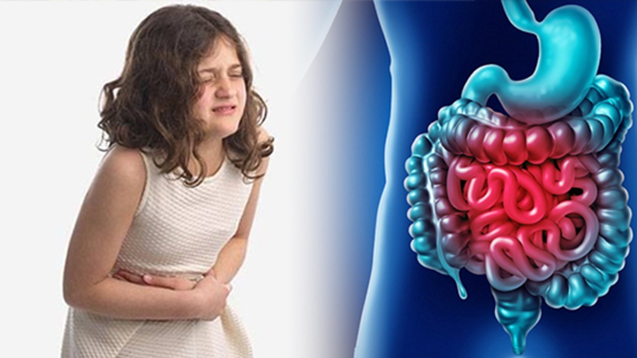 Baccho Ko Pet Dard Kyu hota Hai |Abdominal Migraine Symptoms And Treatment In Hindi |Boldsky