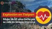 Explosión por gas en Tlalpan: Mujer de 65 años lucha por su vida en terapia intensiva