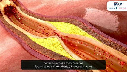 ¿Cómo funcionan y qué son las pruebas de coagulación de la sangre? - #EspecialMSP
