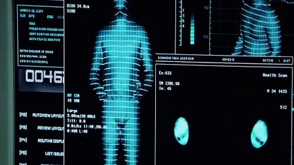 X-Men 2 -  Magneto escapa