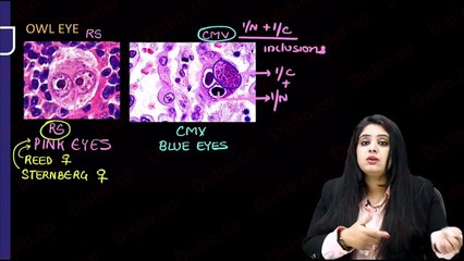 Chronic inflammation // granuloma wound healing // general pathology