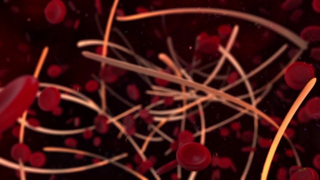 Lupus eritematoso sistemico, testata nuova terapia