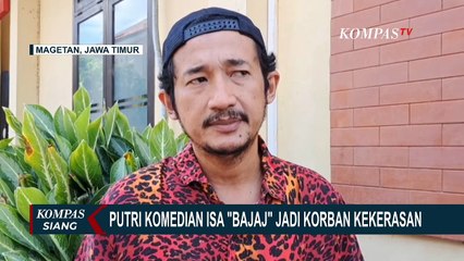 Putri Komedian Isa Bajaj Jadi Korban Kekerasan Pria Tak Dikenal