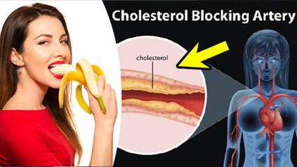 केला खाने से कोलेस्ट्रॉल बढ़ता है या नहीं | Kela Khane Se Cholestrol Badhta Hai Ya Nahi | Boldsky