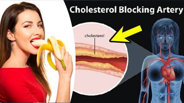केला खाने से कोलेस्ट्रॉल बढ़ता है या नहीं | Kela Khane Se Cholestrol Badhta Hai Ya Nahi | Boldsky