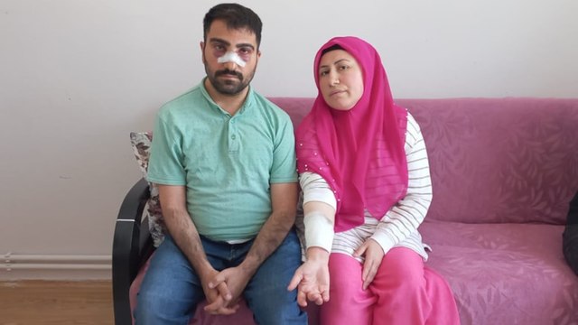 Komşu dehşeti: Engelli adamın önce burnunu kırdı sonra sıcak suyla haşladı