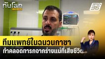 ทีมแพทย์ในฉนวนกาซาทำคลอดทารกจากร่างแม่ที่เสียชีวิต| ทันโลก Express | 22 เม.ย. 67