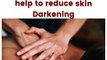 How can Aromatherapy can help to reduce  skin darkening.