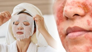 Side Effects Of Face Sheet Mask | रातभर फेस शीट मास्क लगाने के नुकसान | Boldsky