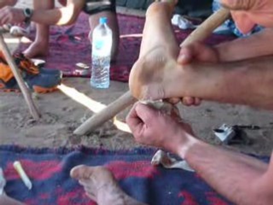 Ampoules Marathon des Sables 2008