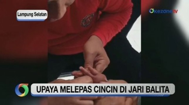 Petugas Damkar Lampung Selatan Bantu Lepas Cincin dari Jari Balita
