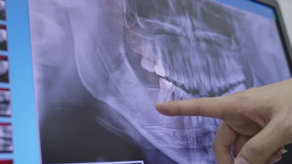 Mann will sich Zahn-Implantat setzen lassen: Plötzlich ist es in seinem Gehirn