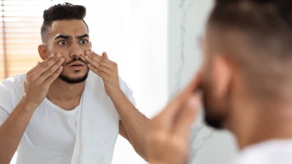 Elimina Las Ojeras Fácilmente