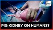 New Jersey woman receives pig kidney, heart pump