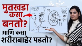 मुतखडा कसा तयार होतो? । How Kidney Stone is Formed | What Causes Kidney Stone | Lokmat Health