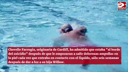 Mujer es alérgica al agua