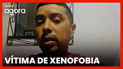 Pensei que ia morrer, diz brasileiro agredido na Irlanda após homem perguntar sua nacionalidade