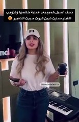 أصيل هميم بعد إزالة الفيلر: هل تخلصت من الملامح الغريبة؟