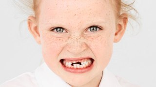 Half of kids have low confidence because of their imperfect teeth - study