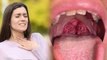 Garmi Me Gala Sukhne Ka Karan|Dry Throat In Summer,Tonsillitis Symptoms & Treatment In Hindi|Boldsky