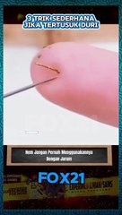 Trik cara mengeluarkan duri di jari tangan