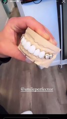 Davido affiche des dents en diamant de 100 millions FCFA (VIDEO)