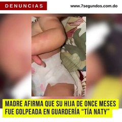 Madre afirma que su hija de once meses fue golpeada en guardería de "Tía Naty"