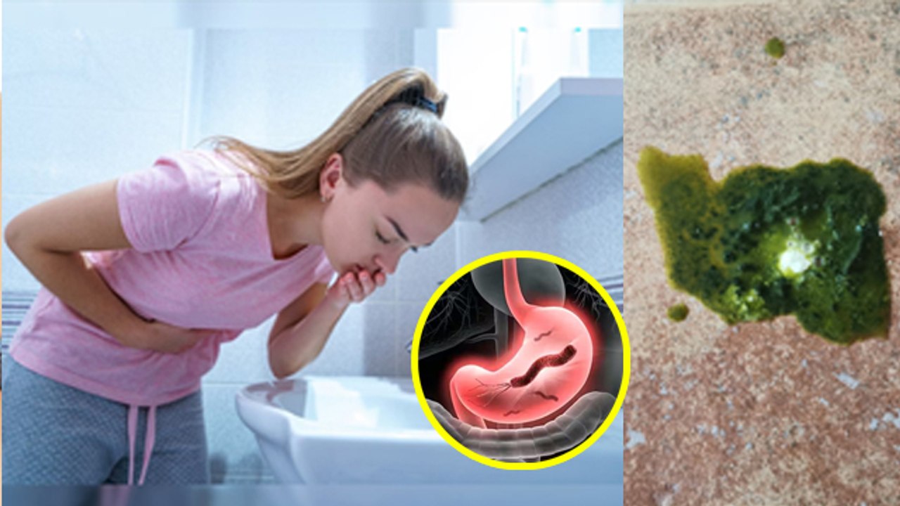 हरे रंग की उल्टी क्यों होती है | Hare Rang Ki Ulti Kyon Hoti Hai | Hare Rang Ki Ulti Hone Ka Karan