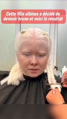 Cette fille albinos voulait du changement