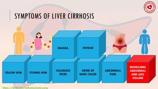 Symptoms of liver cirrhosis