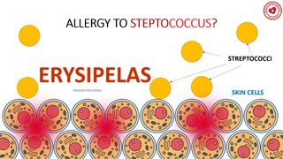 Erysipelas - allergy to streptococcus?