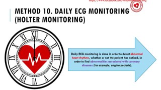 What is daily ECG (Holter) monitoring?