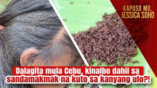 Dalagita mula Cebu, kinalbo dahil sa sandamakmak na kuto sa kanyang ulo?! | Kapuso Mo, Jessica Soho