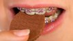 Ortodontista alerta pacientes para alimentos contraindicados para quem usa aparelho ortodôntico