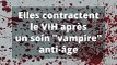 le soin vampire en institut